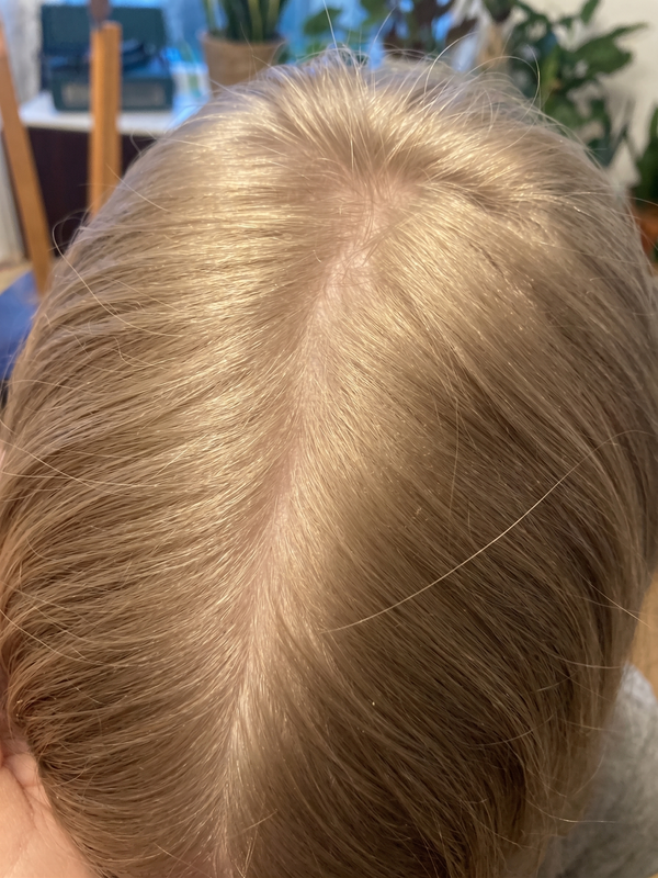 After